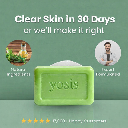 YOSIS® Antifungal Relief Soap Bar